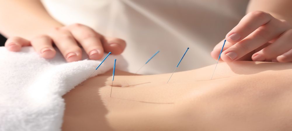 acupuncture-session-cost