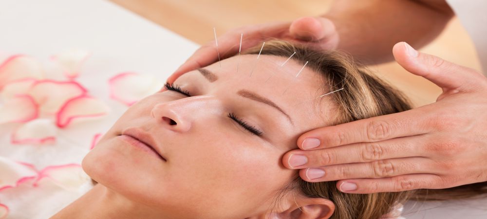 health-benefits-of-acupuncture