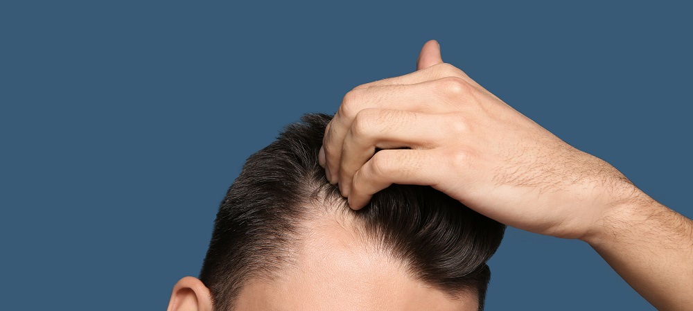 Hair Loss Solution Miami