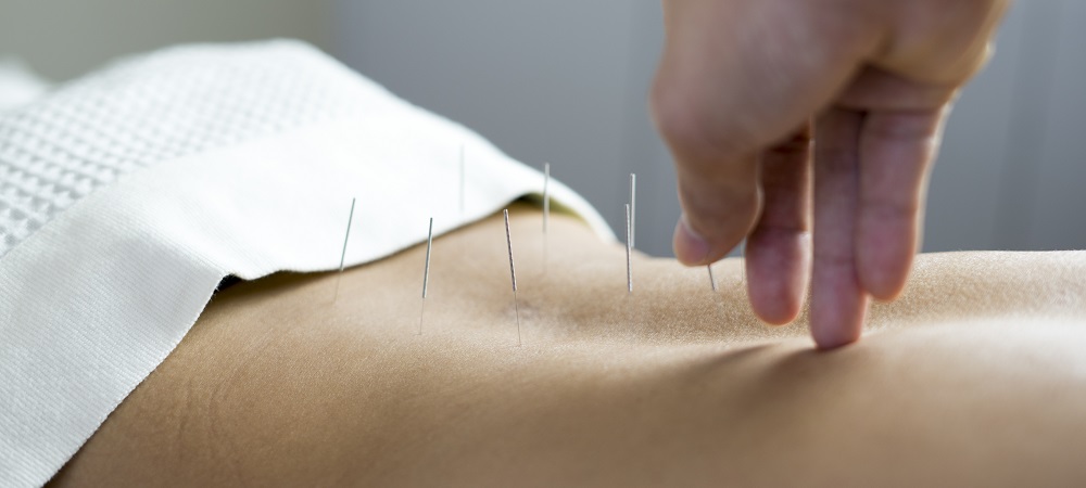 Acupuncture Treatments