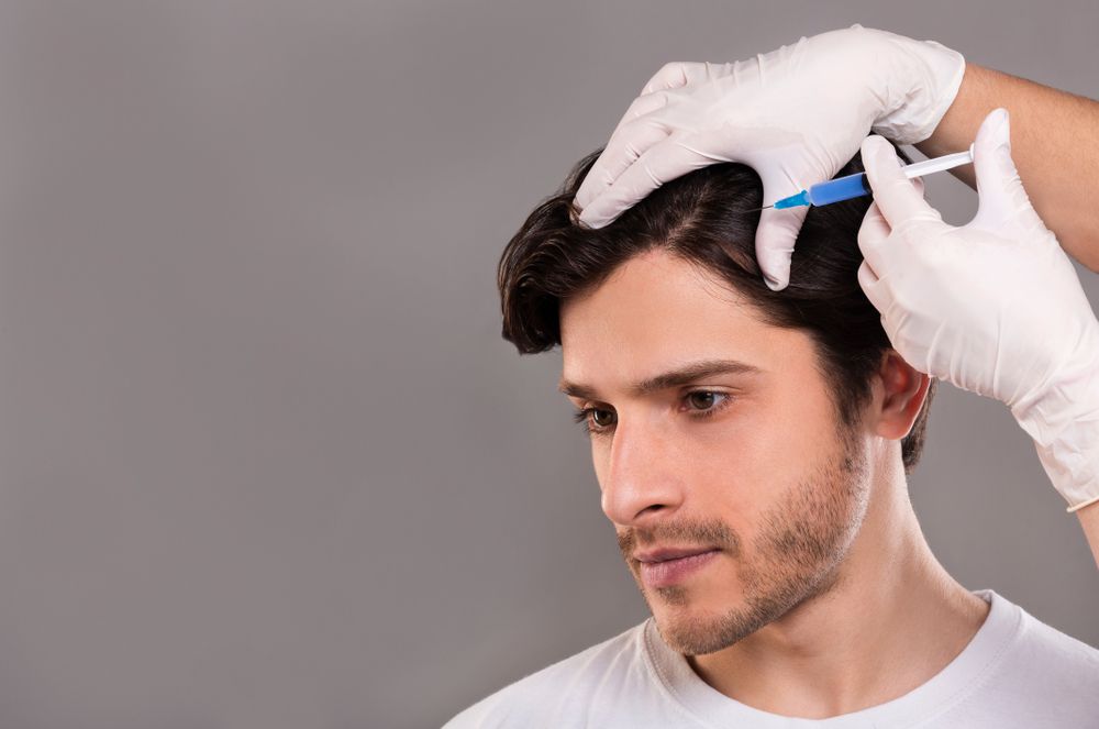 Is the Cost of PRP Micro-needling for Hair Loss Worth It? - Solea Medical Spa