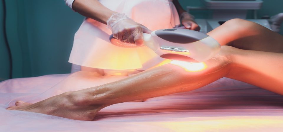 What Is The Cost Of Laser Hair Removal in Miami? - Solea Medical Spa