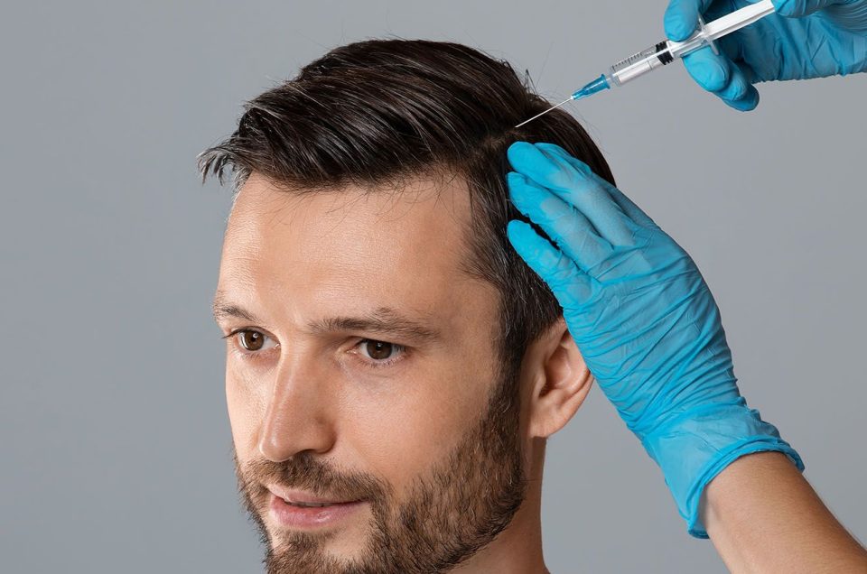 How Does PlateletRich Plasma Therapy PRP Work for Hair Loss  David  Ghozland
