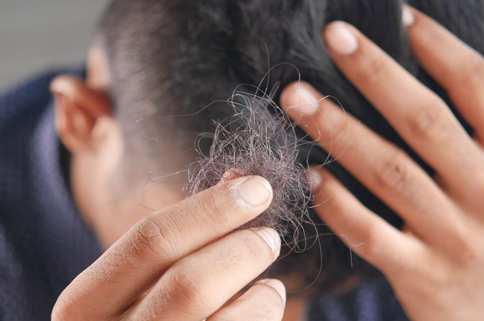 What Kind of Hair Loss is Causing My Bald Spots or Thinning Hair? - Solea Medical Spa What Kind of Hair Loss is Causing My Bald Spots or Thinning Hair? - Solea Medical Spa