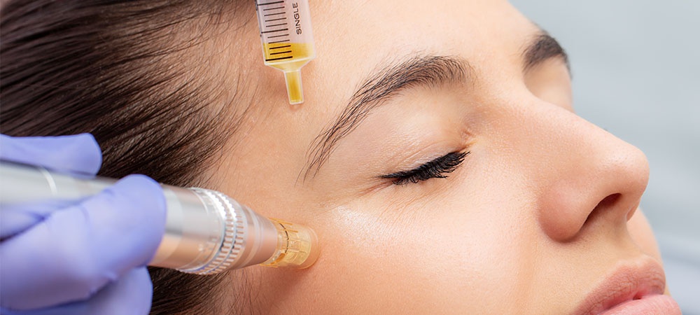 prp therapy for facial rejuvenation
