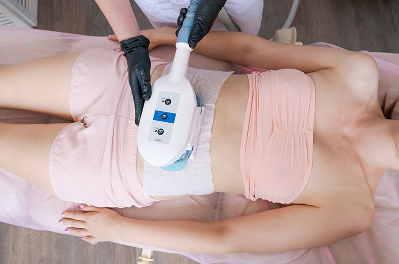 CoolSculpting as a Non-Surgical Fat Reduction Method: An Overview