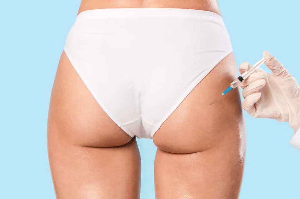 sculptra-butt-lifts-miami-fl