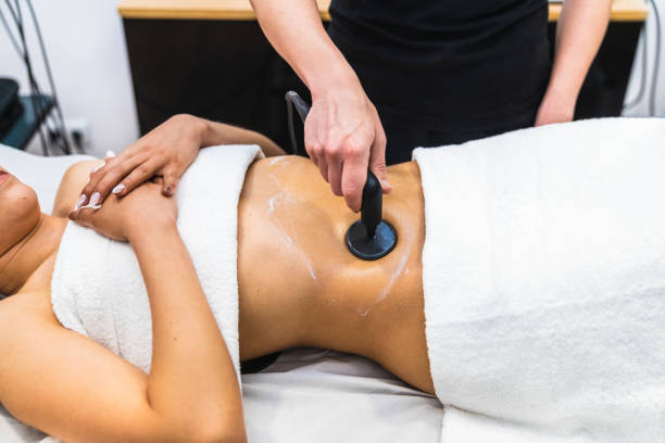 how many rf treatments are needed