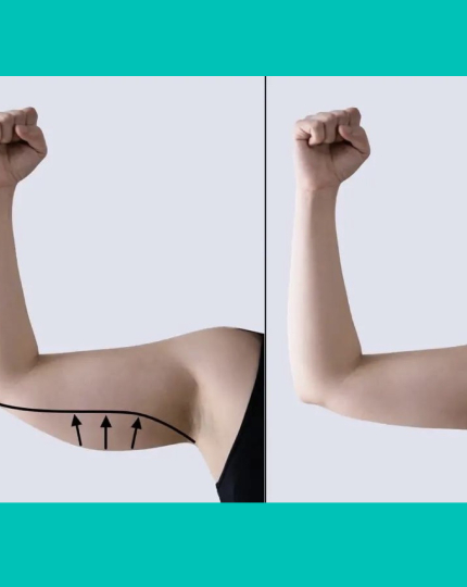 Arms Tightening Treatment