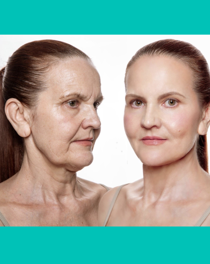 Say Goodbye to Turkey Neck