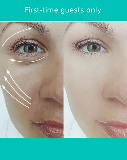 Eye Bags & Under-Eye Puffiness Treatment